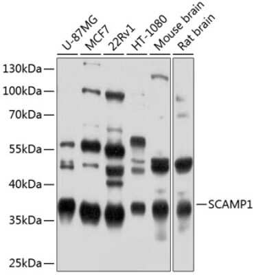 Western Blot: SCAMP1 AntibodyBSA Free [NBP2-93055]