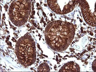Immunohistochemistry: SCAMP2 Antibody (OTI1H10) [NBP2-45688]