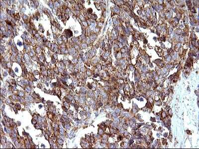 Immunohistochemistry: SCAMP2 Antibody (OTI1H10) [NBP2-45688]