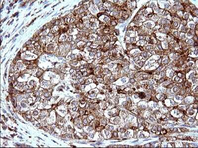 Immunohistochemistry: SCAMP2 Antibody (OTI1H10) [NBP2-45688]