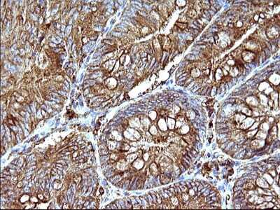 Immunohistochemistry: SCAMP2 Antibody (OTI1H10) [NBP2-45688]