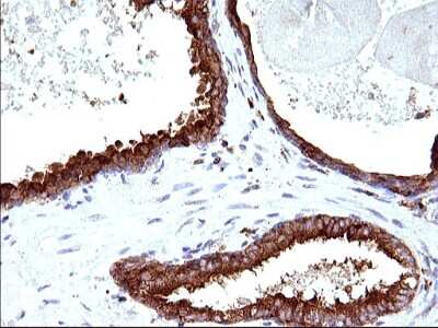 Immunohistochemistry: SCAMP2 Antibody (OTI1H10) [NBP2-45688]