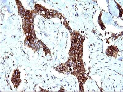 Immunohistochemistry: SCAMP2 Antibody (OTI1H10) [NBP2-45688]