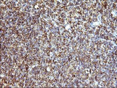 Immunohistochemistry: SCAMP2 Antibody (OTI1H10) [NBP2-45688]