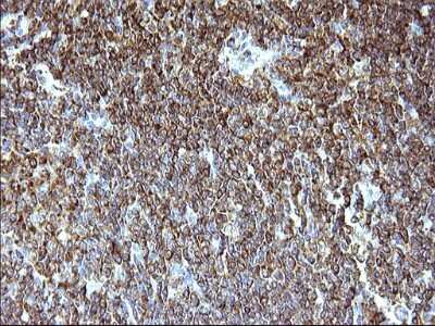 Immunohistochemistry: SCAMP2 Antibody (OTI1H10) [NBP2-45688]
