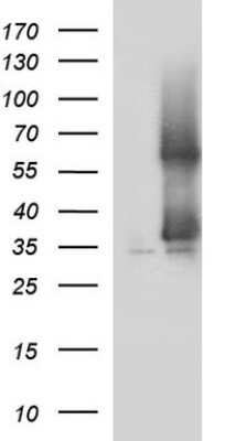 Western Blot: SCAMP2 Antibody (OTI1H10) [NBP2-45688]