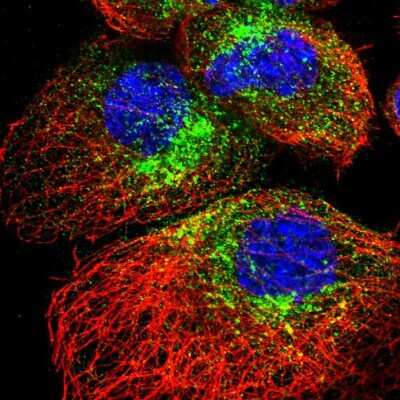 Immunocytochemistry/ Immunofluorescence: SCAMP2 Antibody [NBP1-89552]