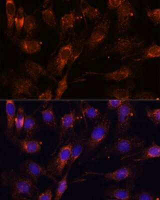 Immunocytochemistry/ Immunofluorescence: SCAMP2 Antibody - Azide and BSA Free [NBP2-93520]