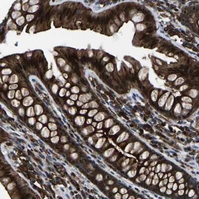 Immunohistochemistry-Paraffin: SCAMP2 Antibody [NBP1-89543]