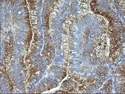 Immunohistochemistry: SCAMP2 Antibody (OTI1H10) - Azide and BSA Free [NBP2-73999]