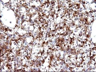 Immunohistochemistry: SCAMP2 Antibody (OTI1H10) - Azide and BSA Free [NBP2-73999]