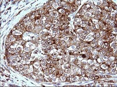Immunohistochemistry: SCAMP2 Antibody (OTI1H10) - Azide and BSA Free [NBP2-73999]