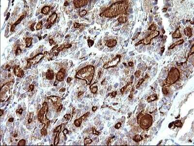 Immunohistochemistry: SCAMP2 Antibody (OTI1H10) - Azide and BSA Free [NBP2-73999]