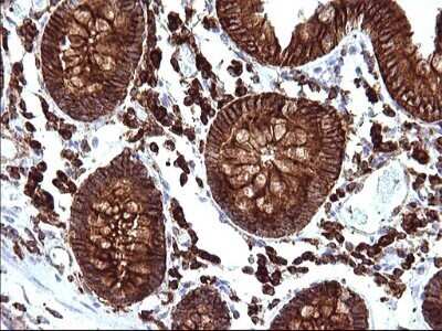Immunohistochemistry: SCAMP2 Antibody (OTI1H10) - Azide and BSA Free [NBP2-73999]