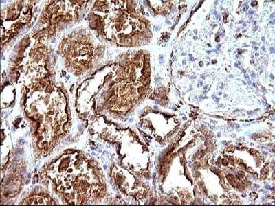 Immunohistochemistry: SCAMP2 Antibody (OTI1H10) - Azide and BSA Free [NBP2-73999]