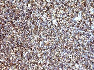 Immunohistochemistry: SCAMP2 Antibody (OTI1H10) - Azide and BSA Free [NBP2-73999]