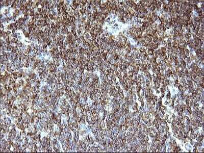 Immunohistochemistry: SCAMP2 Antibody (OTI1H10) - Azide and BSA Free [NBP2-73999]