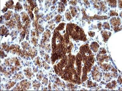 Immunohistochemistry: SCAMP2 Antibody (OTI1H10) - Azide and BSA Free [NBP2-73999]