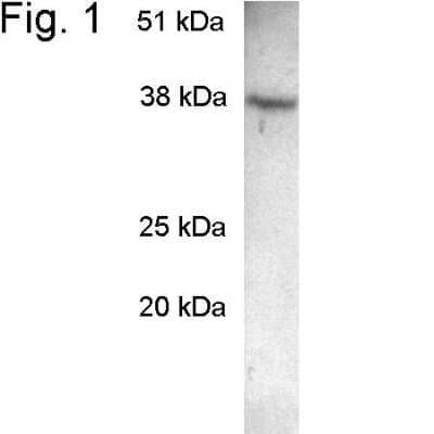 Western Blot: SCAMP2 AntibodyBSA Free [NB120-3431]