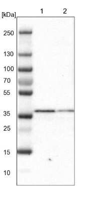 Western Blot: SCAMP2 Antibody [NBP1-89543]