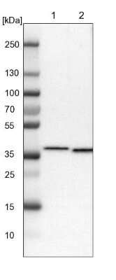 Western Blot: SCAMP2 Antibody [NBP1-89552]