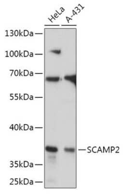 Western Blot: SCAMP2 AntibodyAzide and BSA Free [NBP2-93520]