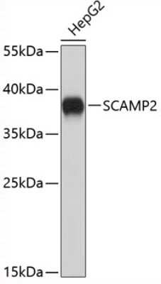 Western Blot: SCAMP2 AntibodyAzide and BSA Free [NBP2-94890]