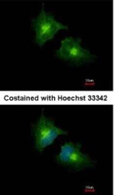 Immunocytochemistry/ Immunofluorescence: SCAMP3 Antibody [NBP1-32099]