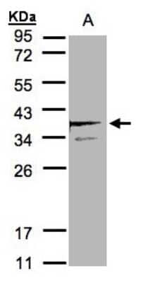 Western Blot: SCAMP3 Antibody [NBP1-32099]