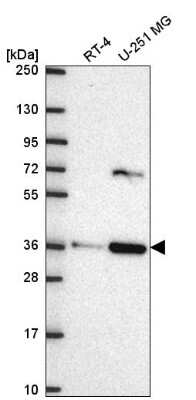 Western Blot: SCAMP3 Antibody [NBP2-56966]