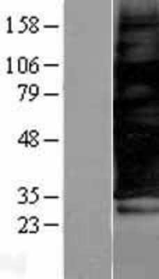 Western Blot: SCAMP3 Overexpression Lysate [NBL1-15712]