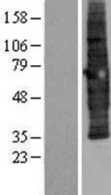 Western Blot: SCAMP3 Overexpression Lysate [NBL1-15713]