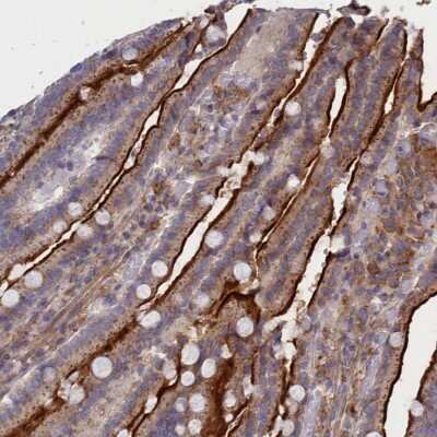 Immunohistochemistry-Paraffin: SCAMP4 Antibody [NBP1-93849]