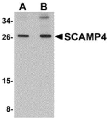 Western Blot: SCAMP4 AntibodyBSA Free [NBP2-81787]