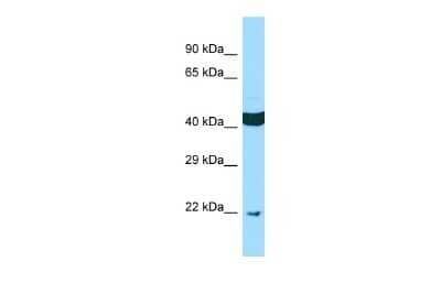 Western Blot: SCAMP4 Antibody [NBP2-83497]