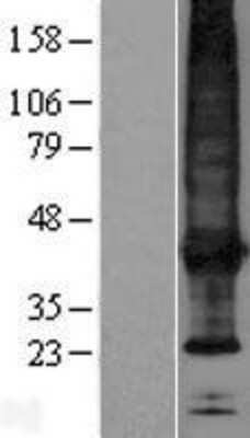 Western Blot: SCAMP4 Overexpression Lysate [NBP2-05792]