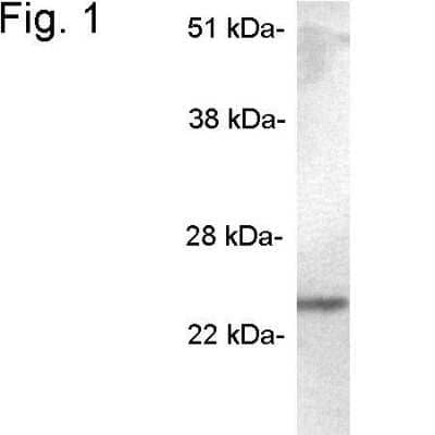 Western Blot: SCAMP5 AntibodyBSA Free [NB120-3432]