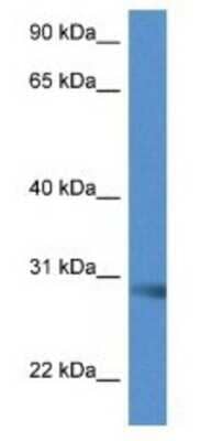 Western Blot: SCAMP5 Antibody [NBP1-79766]