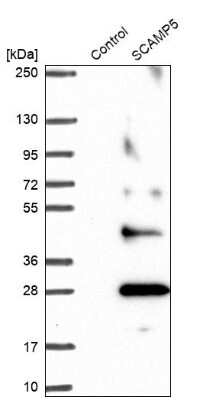 Western Blot: SCAMP5 Antibody [NBP2-13284]