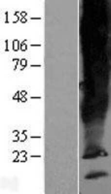 Western Blot: SCAMP5 Overexpression Lysate [NBP2-05614]