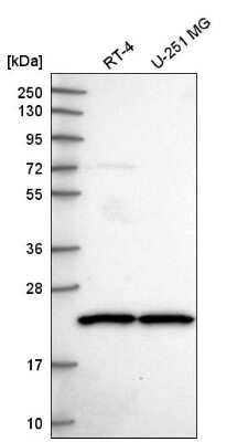 Western Blot: SCAND1 Antibody [NBP2-56092]