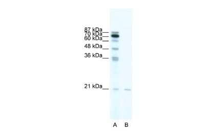 Western Blot: SCAND1 Antibody [NBP2-85693]