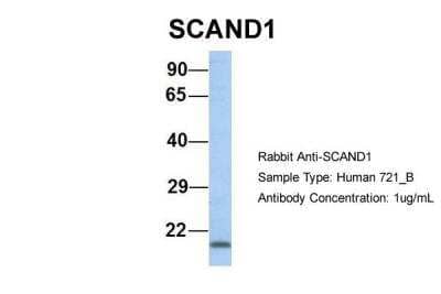 Western Blot: SCAND1 Antibody [NBP2-85695]