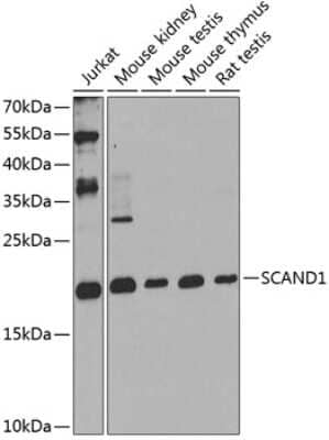 Western Blot: SCAND1 AntibodyBSA Free [NBP2-94906]