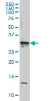 Western Blot: SCAND2 Antibody (7B12) [H00054581-M01]