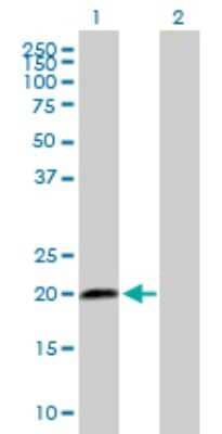 Western Blot: SCAND2 Antibody [H00054581-B01P]