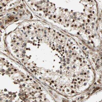 Immunohistochemistry-Paraffin: SCAND3 Antibody [NBP1-82028]