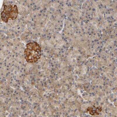 Immunohistochemistry-Paraffin: SCAP Antibody [NBP1-89624]
