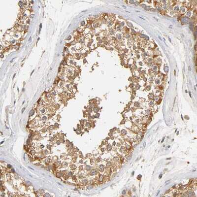 Immunohistochemistry-Paraffin: SCAP Antibody [NBP1-89624]