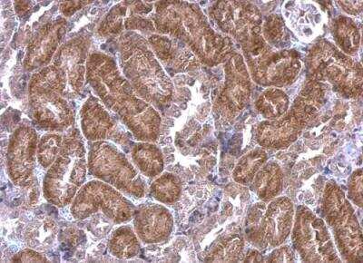 Immunohistochemistry-Paraffin: SCAP Antibody [NBP2-15127]